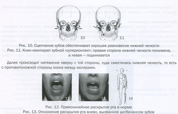 остеопатия и стоматология