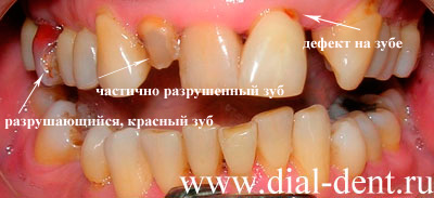 проблемы с зубами, которые решали при лечении