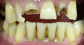 вид до лечения зубов в клинике Диал-Дент Павелецкая