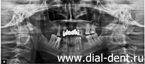 панорамный снимок зубов в "Диал-Дент"