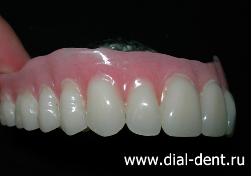 ремонт зубных протезов в "Диал-Дент"