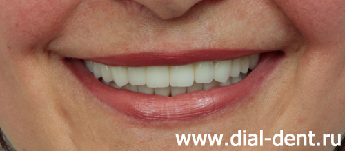 комплексное лечение и протезирование зубов в Диал-Дент