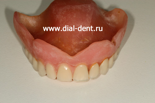 проведен срочный ремонт зубного протеза (Москва, Диал-Дент)
