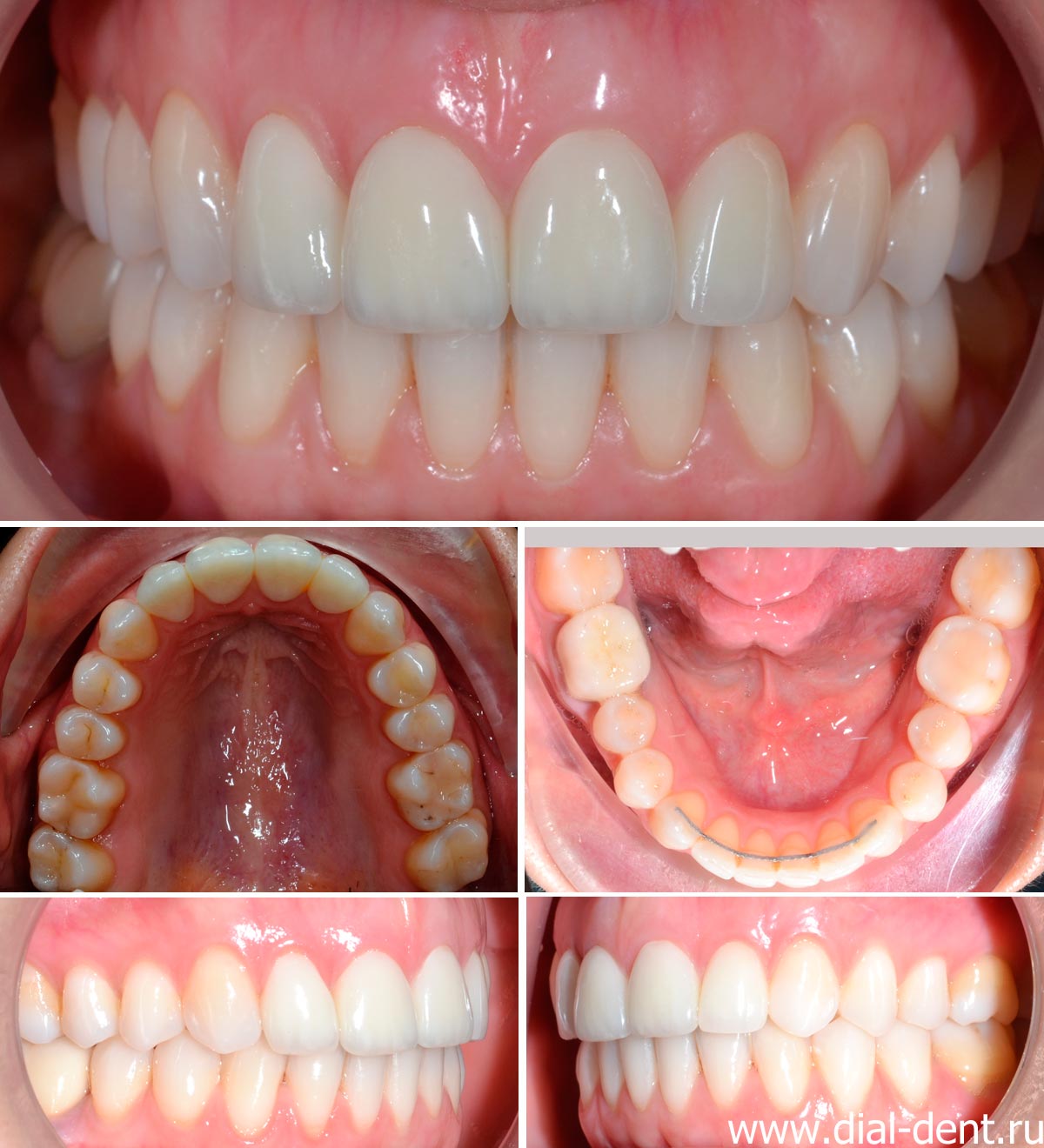 результат комплексного стоматологического лечения