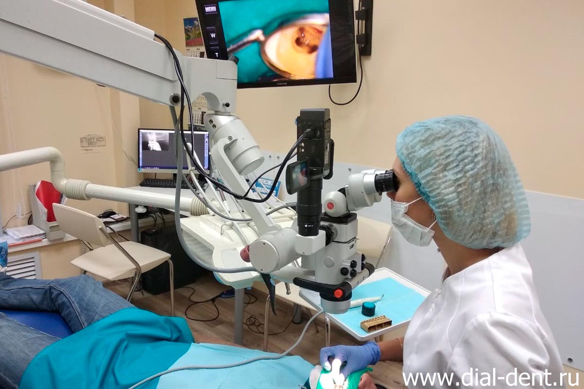 лечение зубов под микроскопом проводит стоматолог-эндодонтист Ушакова В.Л.