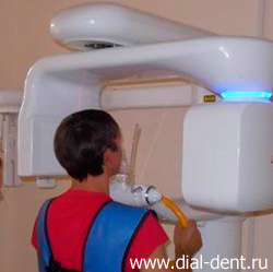 компьютерная томография при лечении каналов зубов