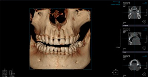 КТ в ортодонтии