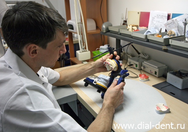 изготовление зубных протезов в Диал-Дент